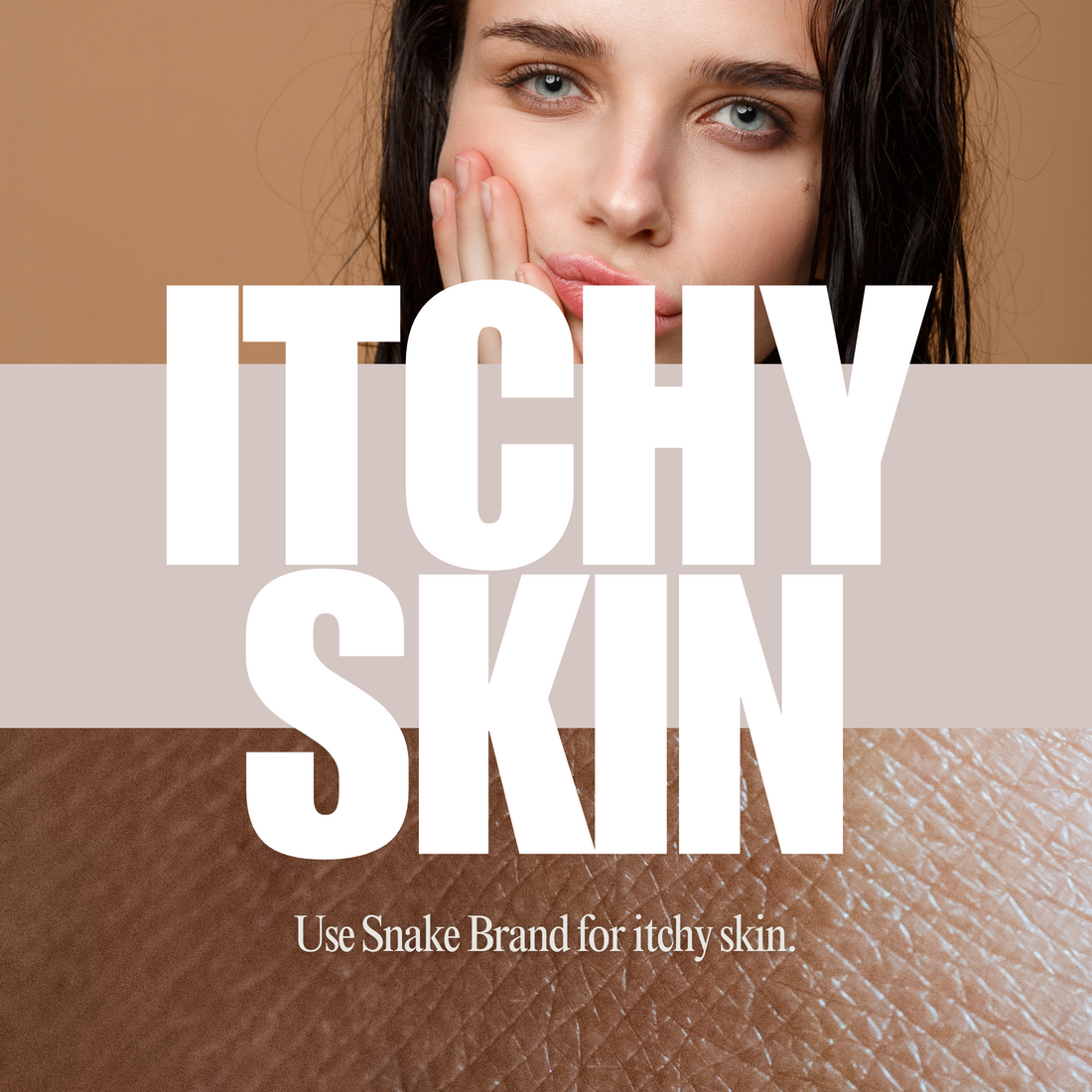 Fungal Infection or Heat Rash? Tell the Difference! – Snake Brand